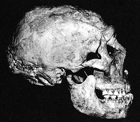 Neanderthal skull